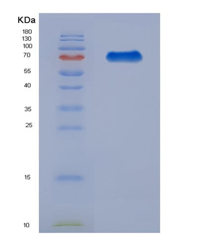 SDS-PAGE analysis of Human HRG (Histidine-Rich Glycoprotein) - Recombinant Protein, CAT# BLT-07820P, showing >90% purity under 15% SDS-PAGE (Reduced)Human HRG (Histidine-Rich Glycoprotein) - Recombinant Protein