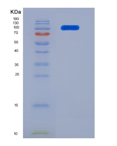 SDS-PAGE analysis of Human FGFR2 (Fibroblast Growth Factor Receptor 2) - Recombinant Protein, CAT# BLT-07823P, showing >90% purity under 15% SDS-PAGE (Reduced)Human FGFR2 (Fibroblast Growth Factor Receptor 2) - Recombinant Protein