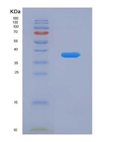 SDS-PAGE analysis of Human ADIPOQ (Adiponectin) - Recombinant Protein, CAT# BLT-07824P, showing >90% purity under 15% SDS-PAGE (Reduced)Human ADIPOQ (Adiponectin) - Recombinant Protein
