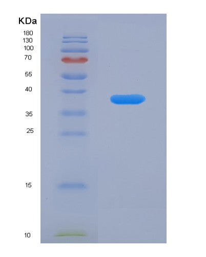 SDS-PAGE analysis of Human ADIPOQ (Adiponectin) - Recombinant Protein, CATHuman ADIPOQ (Adiponectin) - Recombinant Protein