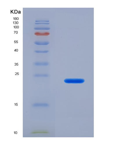 SDS-PAGE analysis of Human IFNL2 (Interferon Lambda-2) - Recombinant Protein, CAT# BLT-07825P, showing >90% purity under 15% SDS-PAGE (Reduced)Human IFNL2 (Interferon Lambda-2) - Recombinant Protein
