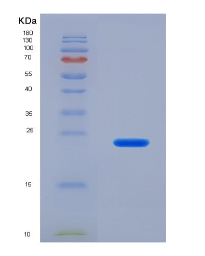 SDS-PAGE analysis of Human IFNL2 (Interferon Lambda-2) - Recombinant Protein, CATHuman IFNL2 (Interferon Lambda-2) - Recombinant Protein