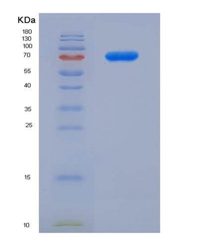 SDS-PAGE analysis of Human HAVCR2 (Hepatitis A Virus Cellular Receptor 2) - Recombinant Protein, CAT# BLT-07827P, showing >90% purity under 15% SDS-PAGE (Reduced)Human HAVCR2 (Hepatitis A Virus Cellular Receptor 2) - Recombinant Protein