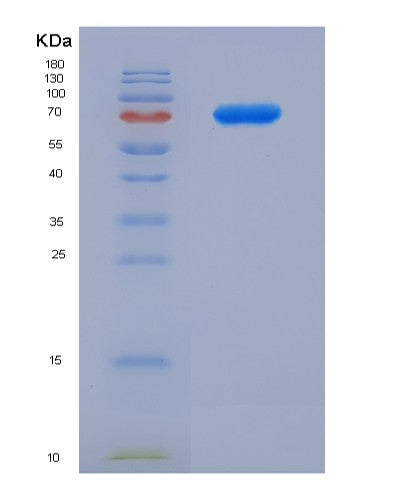 SDS-PAGE analysis of Human HAVCR2 (Hepatitis A Virus Cellular Receptor 2) - Recombinant Protein, CATHuman HAVCR2 (Hepatitis A Virus Cellular Receptor 2) - Recombinant Protein