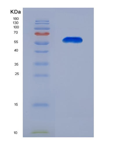 SDS-PAGE analysis of Human BTN3A1 (Butyrophilin Subfamily 3 Member A1) - Recombinant Protein, CAT# BLT-07828P, showing >90% purity under 15% SDS-PAGE (Reduced)Human BTN3A1 (Butyrophilin Subfamily 3 Member A1) - Recombinant Protein