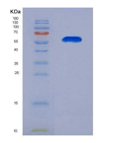SDS-PAGE analysis of Human BTN3A1 (Butyrophilin Subfamily 3 Member A1) - Recombinant Protein, CATHuman BTN3A1 (Butyrophilin Subfamily 3 Member A1) - Recombinant Protein