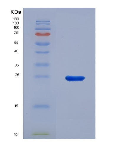 SDS-PAGE analysis of Human CD83 (Cd83 Antigen) - Recombinant Protein, CAT# BLT-07829P, showing >90% purity under 15% SDS-PAGE (Reduced)Human CD83 (Cd83 Antigen) - Recombinant Protein