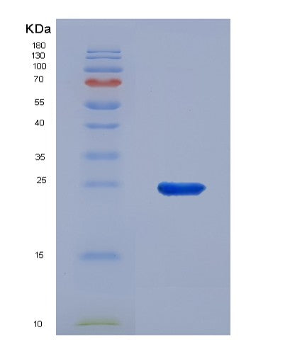 SDS-PAGE analysis of Human CD83 (Cd83 Antigen) - Recombinant Protein, CATHuman CD83 (Cd83 Antigen) - Recombinant Protein