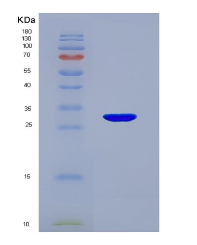 SDS-PAGE analysis of Human IGFBP1 (Insulin-Like Growth Factor-Binding Protein 1) - Recombinant Protein, CAT# BLT-07830P, showing >90% purity under 15% SDS-PAGE (Reduced)Human IGFBP1 (Insulin-Like Growth Factor-Binding Protein 1) - Recombinant Protein