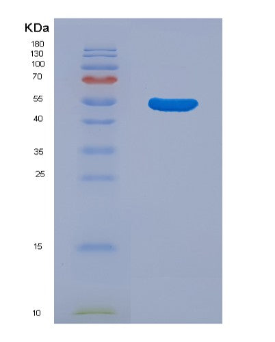 SDS-PAGE analysis of Human CD14 (Monocyte Differentiation Antigen Cd14) - Recombinant Protein, CATHuman CD14 (Monocyte Differentiation Antigen Cd14) - Recombinant Protein