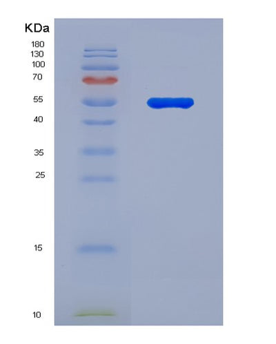 SDS-PAGE analysis of Human SPP1 (Osteopontin) - Recombinant Protein, CAT# BLT-07832P, showing >90% purity under 15% SDS-PAGE (Reduced)Human SPP1 (Osteopontin) - Recombinant Protein