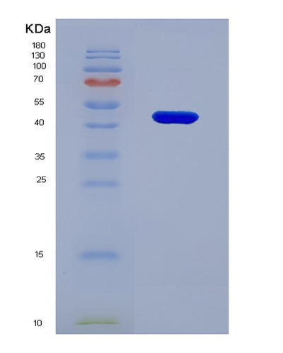 SDS-PAGE analysis of Human CD276 (Cd276 Antigen) - Recombinant Protein, CAT# BLT-03396P, showing >90% purity under 15% SDS-PAGE (Reduced)Human CD276 (Cd276 Antigen) - Recombinant Protein