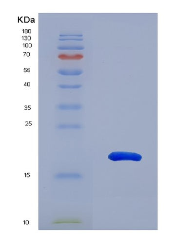 SDS-PAGE analysis of Human TIGIT (T-Cell Immunoreceptor With Ig And Itim Domains) - Recombinant Protein, CAT# BLT-07110P, showing >90% purity under 15% SDS-PAGE (Reduced)Human TIGIT (T-Cell Immunoreceptor With Ig And Itim Domains) - Recombinant Protein