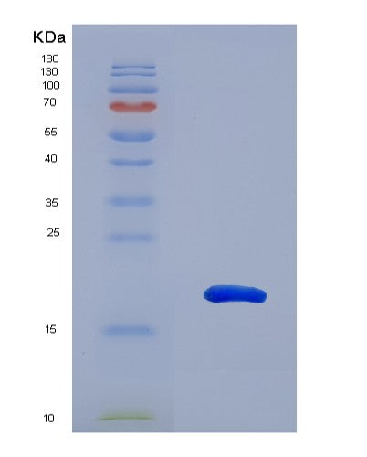 SDS-PAGE analysis of Human TIGIT (T-Cell Immunoreceptor With Ig And Itim Domains) - Recombinant Protein, CATHuman TIGIT (T-Cell Immunoreceptor With Ig And Itim Domains) - Recombinant Protein
