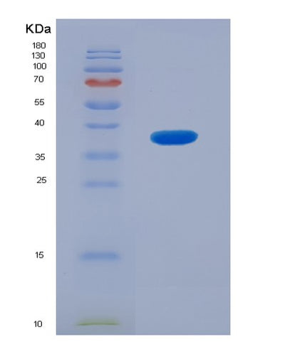 SDS-PAGE analysis of Human FCGR3A (Low Affinity Immunoglobulin Gamma Fc Region Receptor Iii-A) - Recombinant Protein, CAT# BLT-03706P, showing >90% purity under 15% SDS-PAGE (Reduced)Human FCGR3A (Low Affinity Immunoglobulin Gamma Fc Region Receptor Iii-A) - Recombinant Protein