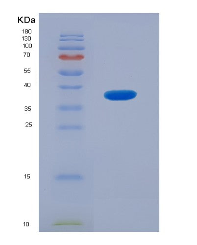 SDS-PAGE analysis of Human FCGR3A (Low Affinity Immunoglobulin Gamma Fc Region Receptor Iii-A) - Recombinant Protein, CATHuman FCGR3A (Low Affinity Immunoglobulin Gamma Fc Region Receptor Iii-A) - Recombinant Protein