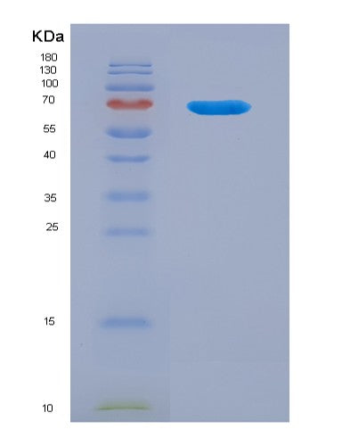 SDS-PAGE analysis of Human THBD (Thrombomodulin) - Recombinant Protein, CATHuman THBD (Thrombomodulin) - Recombinant Protein