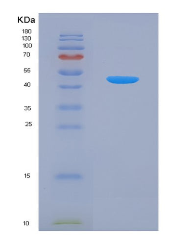 SDS-PAGE analysis of Human CD38 (Adp-Ribosyl Cyclase/Cyclic Adp-Ribose Hydrolase 1) - Recombinant Protein, CAT# BLT-07834P, showing >90% purity under 15% SDS-PAGE (Reduced)Human CD38 (Adp-Ribosyl Cyclase/Cyclic Adp-Ribose Hydrolase 1) - Recombinant Protein
