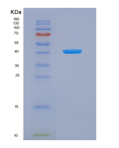 SDS-PAGE analysis of Human AZGP1 (Zinc-Alpha-2-Glycoprotein) - Recombinant Protein, CAT# BLT-03684P, showing >90% purity under 15% SDS-PAGE (Reduced)Human AZGP1 (Zinc-Alpha-2-Glycoprotein) - Recombinant Protein