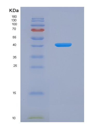 SDS-PAGE analysis of Human AZGP1 (Zinc-Alpha-2-Glycoprotein) - Recombinant Protein, CATHuman AZGP1 (Zinc-Alpha-2-Glycoprotein) - Recombinant Protein