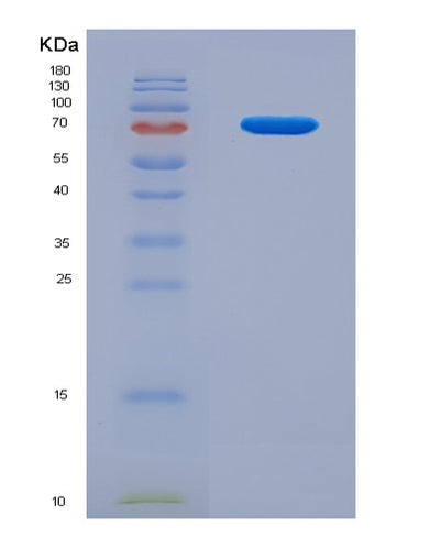 SDS-PAGE analysis of Human NECTIN1 (Nectin-1) - Recombinant Protein, CAT# BLT-05951P, showing >95% purity under 15% SDS-PAGE (Reduced)Human NECTIN1 (Nectin-1) - Recombinant Protein