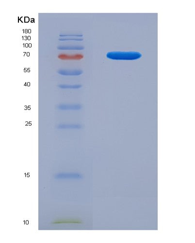 SDS-PAGE analysis of Human NECTIN1 (Nectin-1) - Recombinant Protein, CATHuman NECTIN1 (Nectin-1) - Recombinant Protein