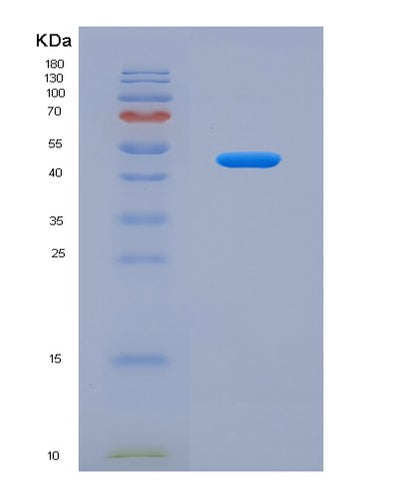 SDS-PAGE analysis of Human DKK3 (Dickkopf-Related Protein 3) - Recombinant Protein, CAT# BLT-04171P, showing >85% purity under 15% SDS-PAGE (Reduced)Human DKK3 (Dickkopf-Related Protein 3) - Recombinant Protein