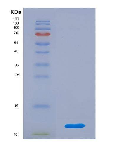SDS-PAGE analysis of Human C4B (Complement C4-B) - Recombinant Protein, CAT# BLT-07839P, showing >90% purity under 15% SDS-PAGE (Reduced)Human C4B (Complement C4-B) - Recombinant Protein