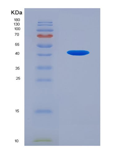 SDS-PAGE analysis of Human C4A (Complement C4-A) - Recombinant Protein, CAT# BLT-07840P, showing >90% purity under 15% SDS-PAGE (Reduced)Human C4A (Complement C4-A) - Recombinant Protein