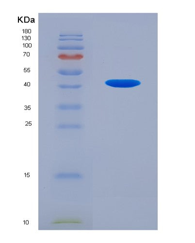SDS-PAGE analysis of Human C4A (Complement C4-A) - Recombinant Protein, CATHuman C4A (Complement C4-A) - Recombinant Protein