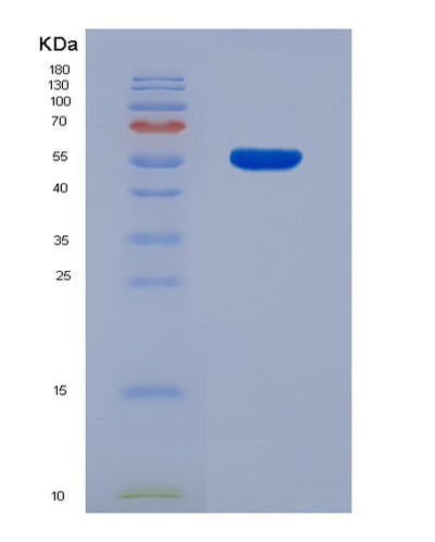 SDS-PAGE analysis of Human FDXR (Nadph:Adrenodoxin Oxidoreductase, Mitochondrial) - Recombinant Protein, CAT# BLT-07841P, showing >90% purity under 15% SDS-PAGE (Reduced)Human FDXR (Nadph:Adrenodoxin Oxidoreductase, Mitochondrial) - Recombinant Protein