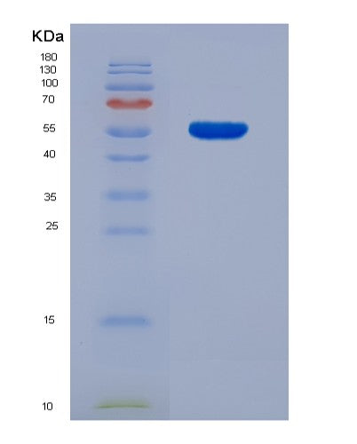 SDS-PAGE analysis of Human FDXR (Nadph:Adrenodoxin Oxidoreductase, Mitochondrial) - Recombinant Protein, CATHuman FDXR (Nadph:Adrenodoxin Oxidoreductase, Mitochondrial) - Recombinant Protein