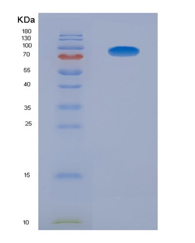 SDS-PAGE analysis of Human AGER (Advanced Glycosylation End Product-Specific Receptor) - Recombinant Protein, CAT# BLT-04159P, showing >85% purity under 15% SDS-PAGE (Reduced)Human AGER (Advanced Glycosylation End Product-Specific Receptor) - Recombinant Protein