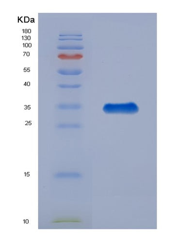 SDS-PAGE analysis of Human IGFBP4 (Insulin-Like Growth Factor-Binding Protein 4) - Recombinant Protein, CAT# BLT-03666P, showing >95% purity under 15% SDS-PAGE (Reduced)Human IGFBP4 (Insulin-Like Growth Factor-Binding Protein 4) - Recombinant Protein