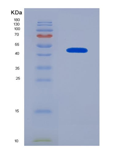 SDS-PAGE analysis of Human PTX3 (Pentraxin-Related Protein Ptx3) - Recombinant Protein, CAT# BLT-05530P, showing >95% purity under 15% SDS-PAGE (Reduced)Human PTX3 (Pentraxin-Related Protein Ptx3) - Recombinant Protein