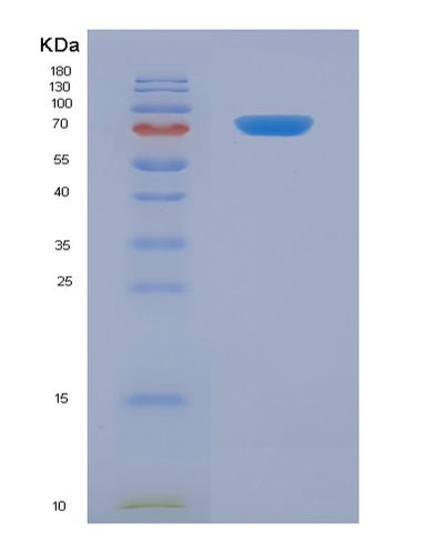 SDS-PAGE analysis of Human GHR (Growth Hormone Receptor) - Recombinant Protein, CAT# BLT-07844P, showing >90% purity under 15% SDS-PAGE (Reduced)Human GHR (Growth Hormone Receptor) - Recombinant Protein