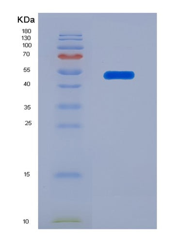 SDS-PAGE analysis of Human LTBR (Tumor Necrosis Factor Receptor Superfamily Member 3) - Recombinant Protein, CAT# BLT-03420P, showing >90% purity under 15% SDS-PAGE (Reduced)Human LTBR (Tumor Necrosis Factor Receptor Superfamily Member 3) - Recombinant Protein