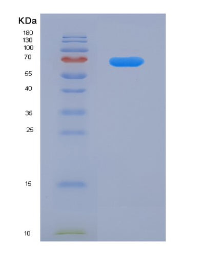 SDS-PAGE analysis of Human CX3CL1 (Fractalkine) - Recombinant Protein, CAT# BLT-04557P, showing >95% purity under 15% SDS-PAGE (Reduced)Human CX3CL1 (Fractalkine) - Recombinant Protein