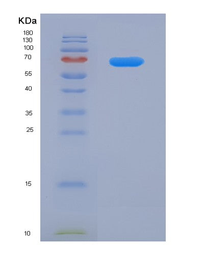 SDS-PAGE analysis of Human CX3CL1 (Fractalkine) - Recombinant Protein, CATHuman CX3CL1 (Fractalkine) - Recombinant Protein