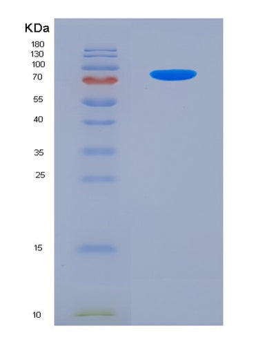 SDS-PAGE analysis of Human PVR (Poliovirus Receptor) - Recombinant Protein, CAT# BLT-05867P, showing >85% purity under 15% SDS-PAGE (Reduced)Human PVR (Poliovirus Receptor) - Recombinant Protein