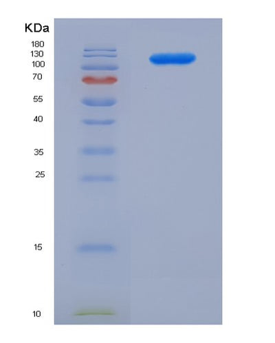 SDS-PAGE analysis of Human CD22 (B-Cell Receptor Cd22) - Recombinant Protein, CAT# BLT-06142P, showing >85% purity under 15% SDS-PAGE (Reduced)Human CD22 (B-Cell Receptor Cd22) - Recombinant Protein