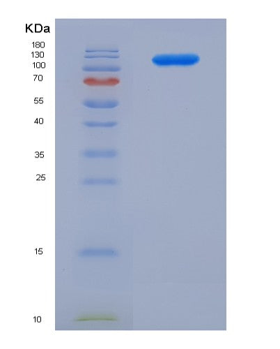 SDS-PAGE analysis of Human CD22 (B-Cell Receptor Cd22) - Recombinant Protein, CATHuman CD22 (B-Cell Receptor Cd22) - Recombinant Protein