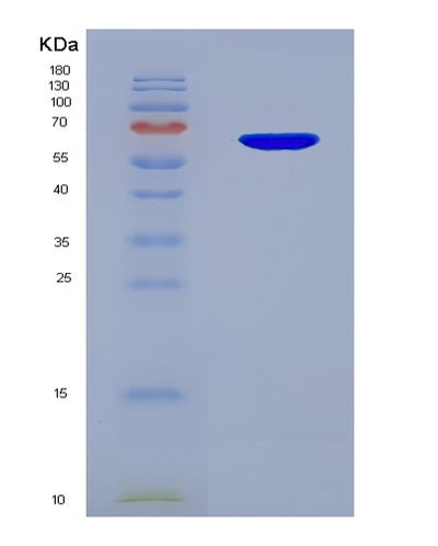 SDS-PAGE analysis of Human FGFR1 (Fibroblast Growth Factor Receptor 1) - Recombinant Protein, CAT# BLT-06150P, showing >85% purity under 15% SDS-PAGE (Reduced)Human FGFR1 (Fibroblast Growth Factor Receptor 1) - Recombinant Protein