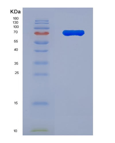 SDS-PAGE analysis of Human IL1RL2 (Interleukin-1 Receptor-Like 2) - Recombinant Protein, CAT# BLT-03722P, showing >85% purity under 15% SDS-PAGE (Reduced)Human IL1RL2 (Interleukin-1 Receptor-Like 2) - Recombinant Protein