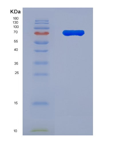 SDS-PAGE analysis of Human IL1RL2 (Interleukin-1 Receptor-Like 2) - Recombinant Protein, CATHuman IL1RL2 (Interleukin-1 Receptor-Like 2) - Recombinant Protein