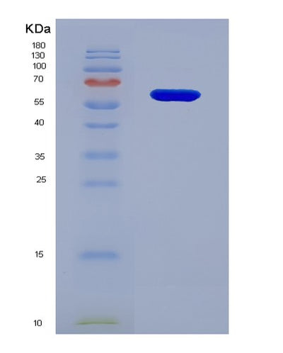 SDS-PAGE analysis of Human IL20RB (Interleukin-20 Receptor Subunit Beta) - Recombinant Protein, CAT# BLT-03842P, showing >85% purity under 15% SDS-PAGE (Reduced)Human IL20RB (Interleukin-20 Receptor Subunit Beta) - Recombinant Protein