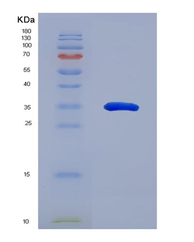 SDS-PAGE analysis of Human IL24 (Interleukin-24) - Recombinant Protein, CAT# BLT-07849P, showing >90% purity under 15% SDS-PAGE (Reduced)Human IL24 (Interleukin-24) - Recombinant Protein