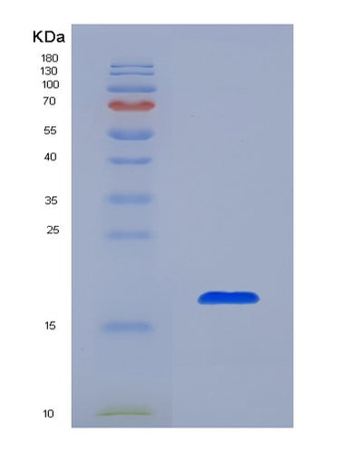 SDS-PAGE analysis of Human IL36B (Interleukin-36 Beta) - Recombinant Protein, CAT# BLT-07850P, showing >90% purity under 15% SDS-PAGE (Reduced)Human IL36B (Interleukin-36 Beta) - Recombinant Protein