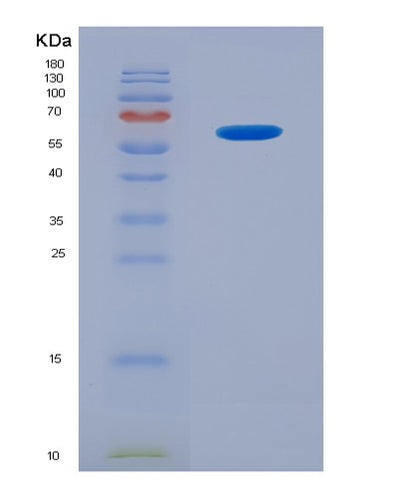 SDS-PAGE analysis of Human TNFSF13 (Tumor Necrosis Factor Ligand Superfamily Member 13) - Recombinant Protein, CAT# BLT-07851P, showing >90% purity under 15% SDS-PAGE (Reduced)Human TNFSF13 (Tumor Necrosis Factor Ligand Superfamily Member 13) - Recombinant Protein
