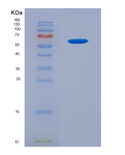 SDS-PAGE analysis of Human TNFSF13 (Tumor Necrosis Factor Ligand Superfamily Member 13) - Recombinant Protein, CATHuman TNFSF13 (Tumor Necrosis Factor Ligand Superfamily Member 13) - Recombinant Protein
